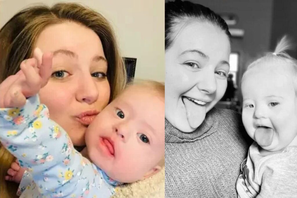 Mãe descobre síndrome de Down com 23 anos