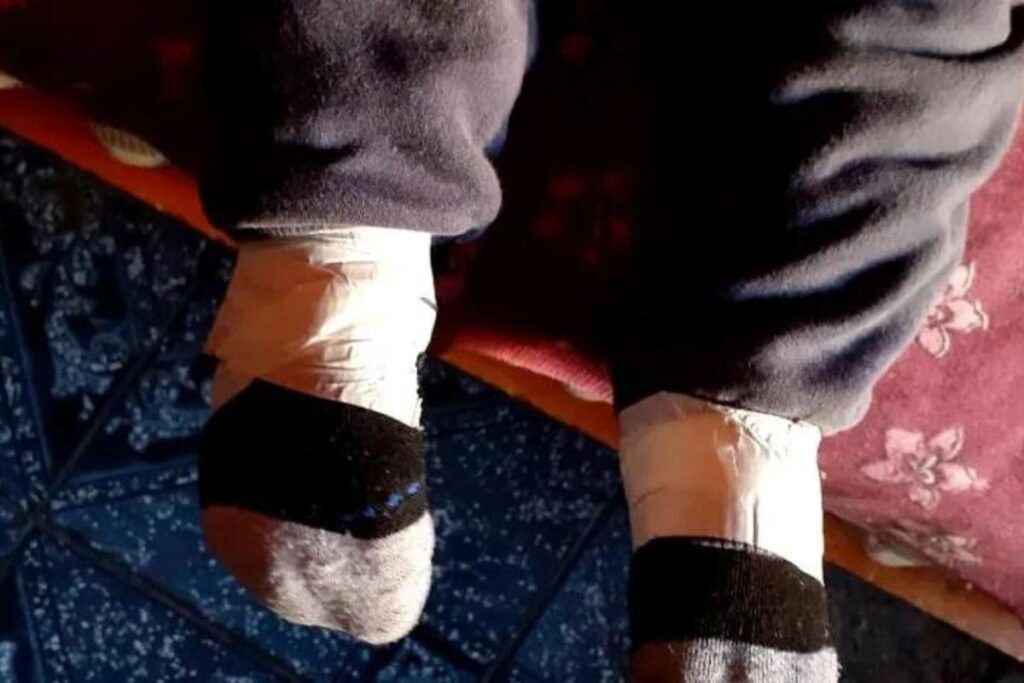 Criança teve as pernas amarradas com fita crepe no interior de MG
