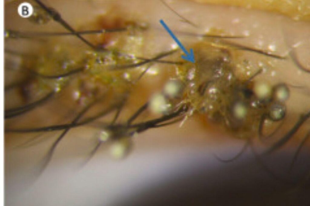 O menino estava brincando no parquinho da escola