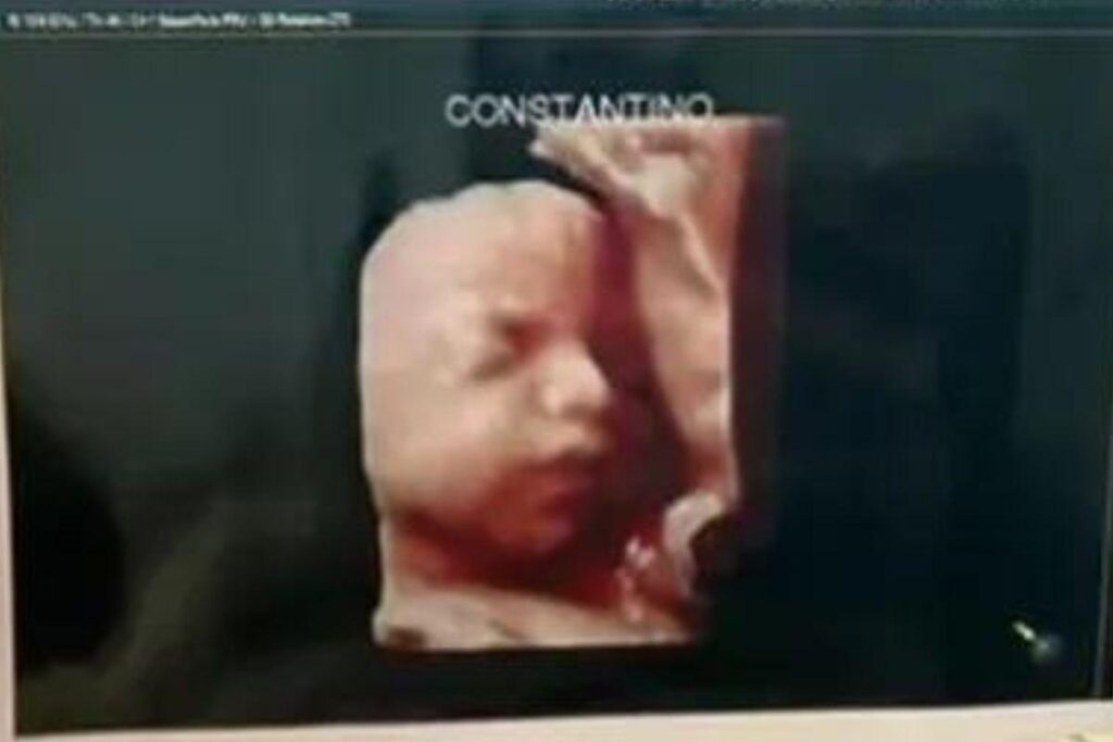 Ultrassonografia entregue pela clínica às mães