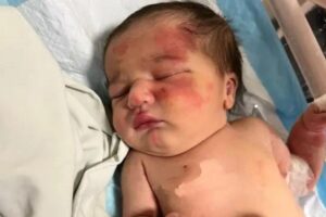 Bebê é encontrado em sacola levada por cão no Líbano