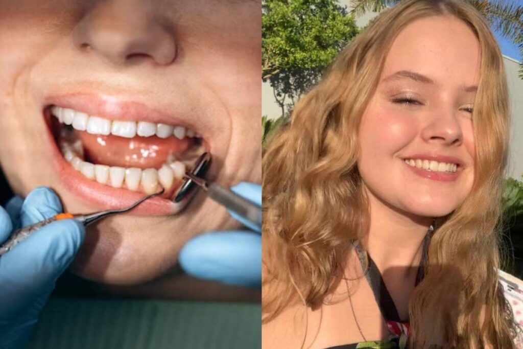 Isadora Belon, morreu quatro dias após extrair o dente do siso