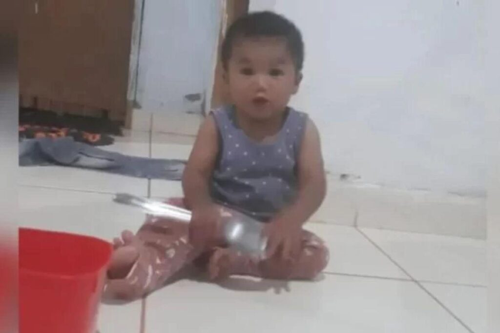 O bebê teve o corpo queimado