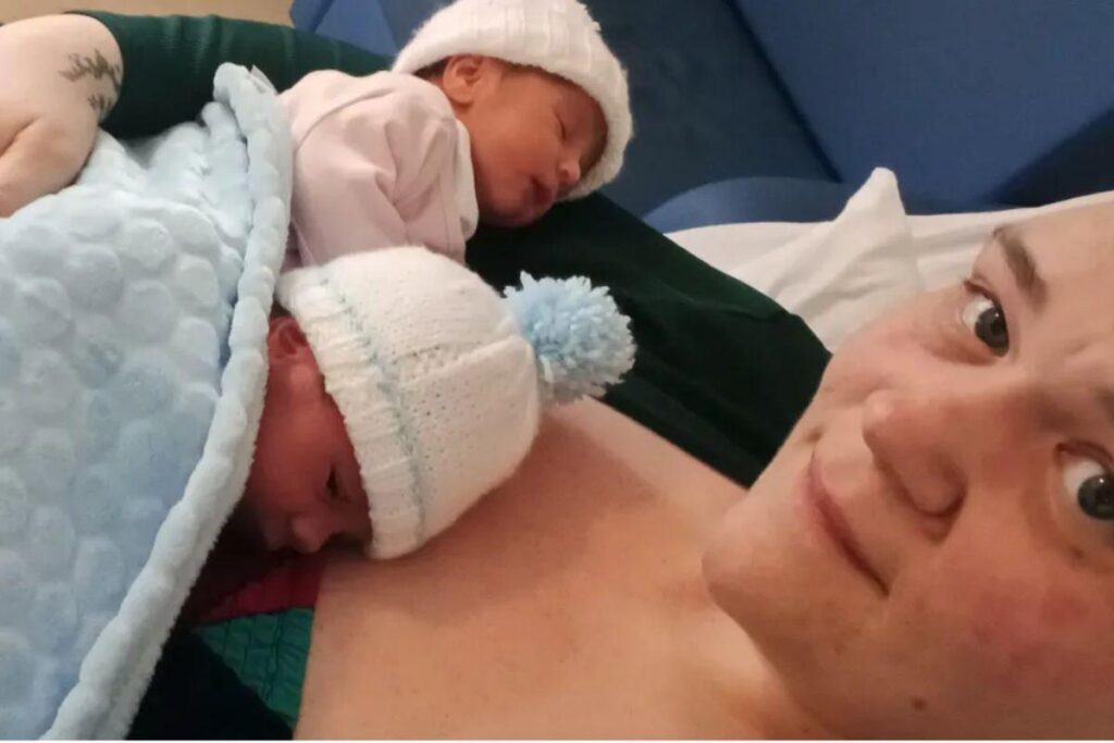 Gêmeos nascem ao mesmo tempo em caso raro