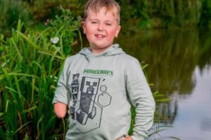 “Com seu novo braço de herói, ele está muito mais independente”, afirma o pai