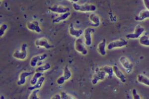 ‘Ameba comedora de cérebro' provaca morte de homem nos EUA