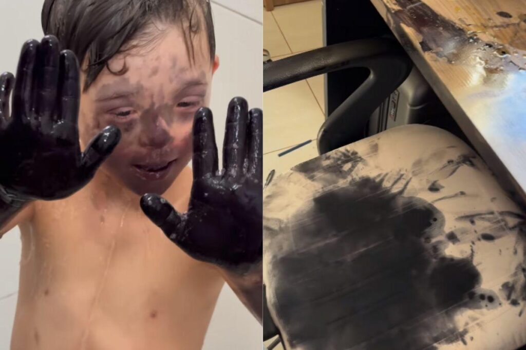 Gabriella Conde, disse que a tinta demorou seis dias para sair