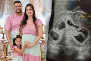O médico explicou se os bebês tem possibilidade de serem idênticos