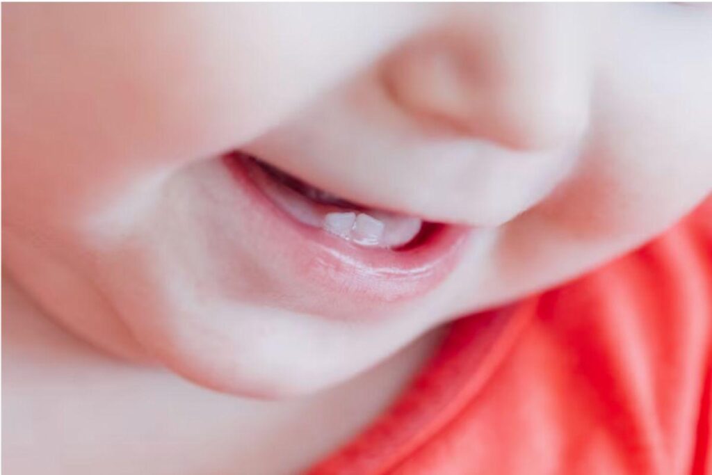 Entenda como passar pela fase do nascimento dos primeiros dentes do bebê