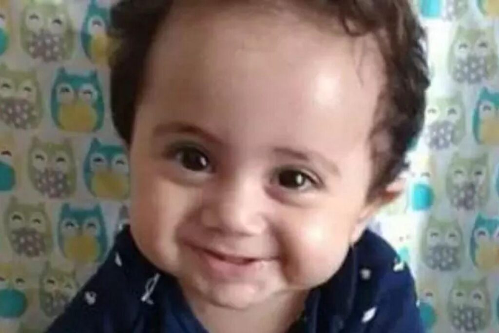 A mãe contou que a pálpebra do bebê foi cortada durante o parto