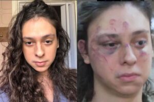 O ator iniciou a carreira através de vídeos na internet, e conquistou espaço na mídia nacional