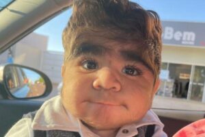 O pai do bebê conta que nascer com muitos pelos é algo comum na família