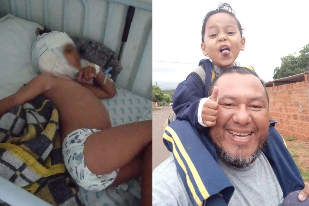 O menino foi atacado por um pitbull