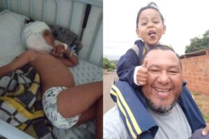 O menino foi atacado por um pitbull