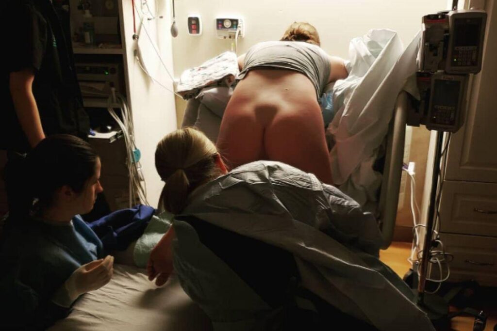 O Polígono de Michaelis é algo comum em todas as gestantes durante o parto