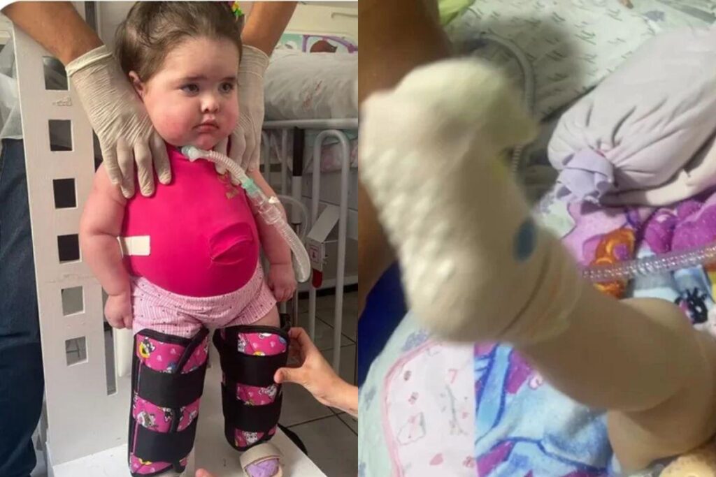 Ela conseguiu mexer as pernas pela primeira vez