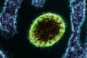 Nipah: vírus mortal faz Índia fechar escolas e empresas para conter surto