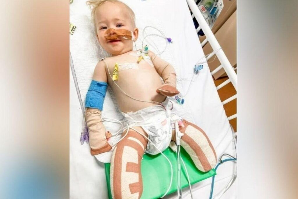 Menino de 1 ano que estava internado com coriza tem pernas e dedos amputados por infecção