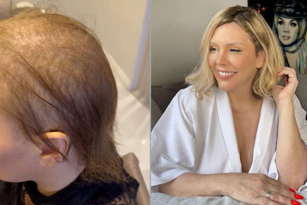 Simony está se preparando para retomar o tratamento contra o câncer: “Mais essa luta”