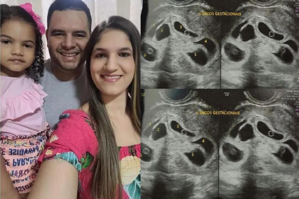 O médico explicou se os bebês tem possibilidade de serem idênticos