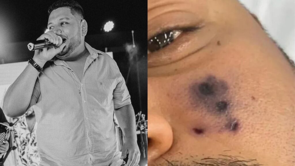 Darlyn Morais, de 28 anos, morreu após ser picado por uma aranha