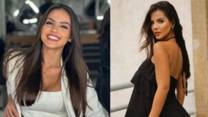 Luana Andrade tinha lipedema, doença crônica que se caracteriza pelo depósito desproporcional de gordura nas pernas e braços