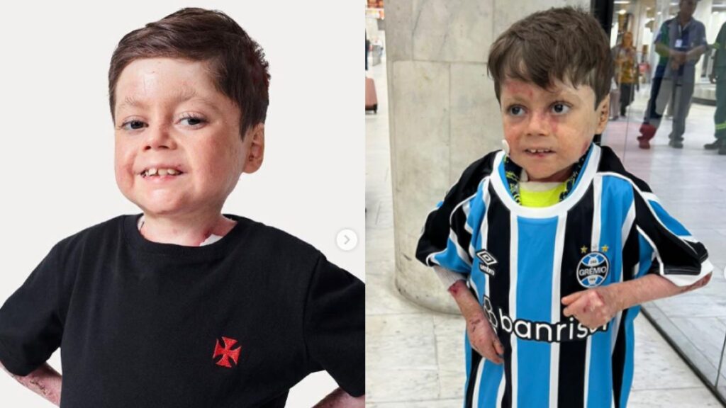 Gui foi atacado por ser vascaíno e cantar o hino do Fluminense