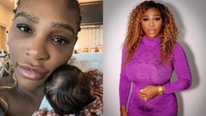 Serena Williams usa leite materno como remédio para queimadura