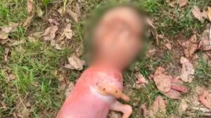 Bezerro nasce com "cabeça humana"