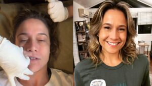 Fernanda Gentil posta stories da fisioterapia facial para tratar Paralisia de Bell
