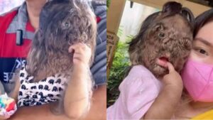 A menina nasceu com uma doença rara