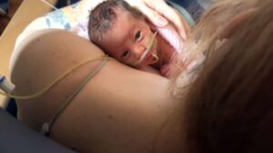 Bebê nasce com órgãos para fora do corpo