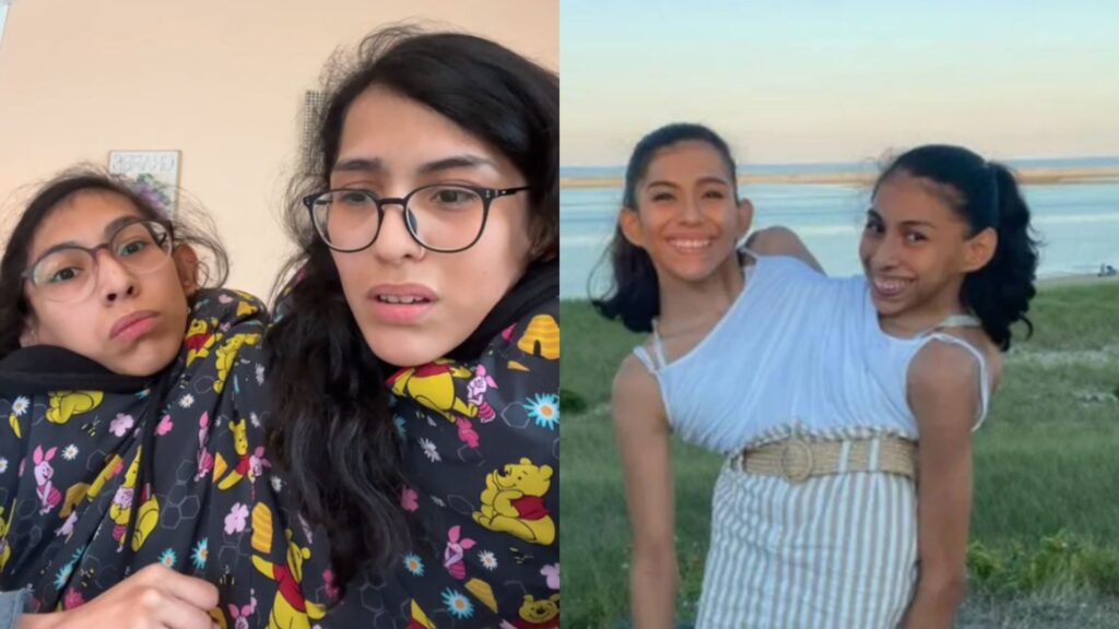 Gêmeas siamesas falam sobre relacionamento