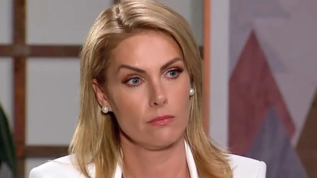 Essa é a primeira vez que Ana Hickmann mostra os hematomas