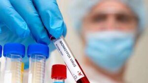 Varíola dos macacos