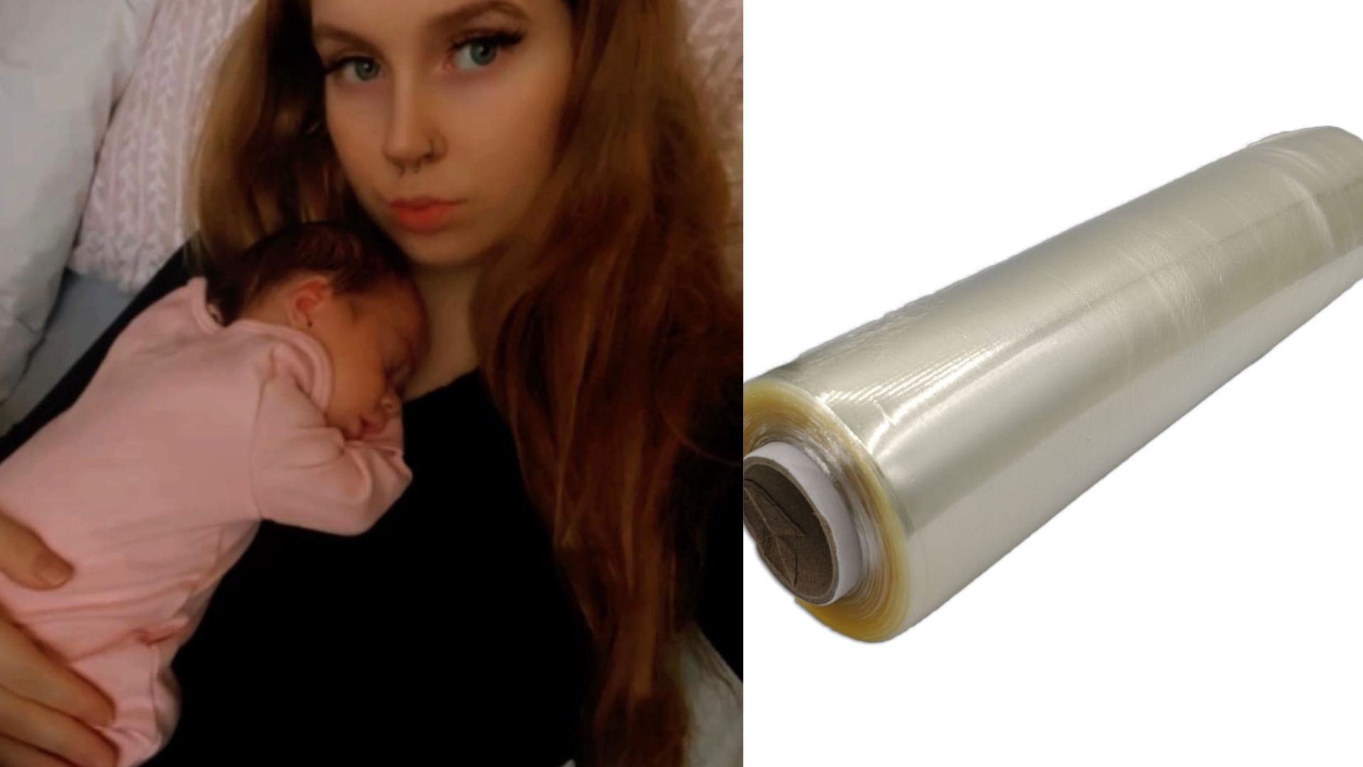 Beb&ecirc; nasce com &oacute;rg&atilde;os para fora do corpo 