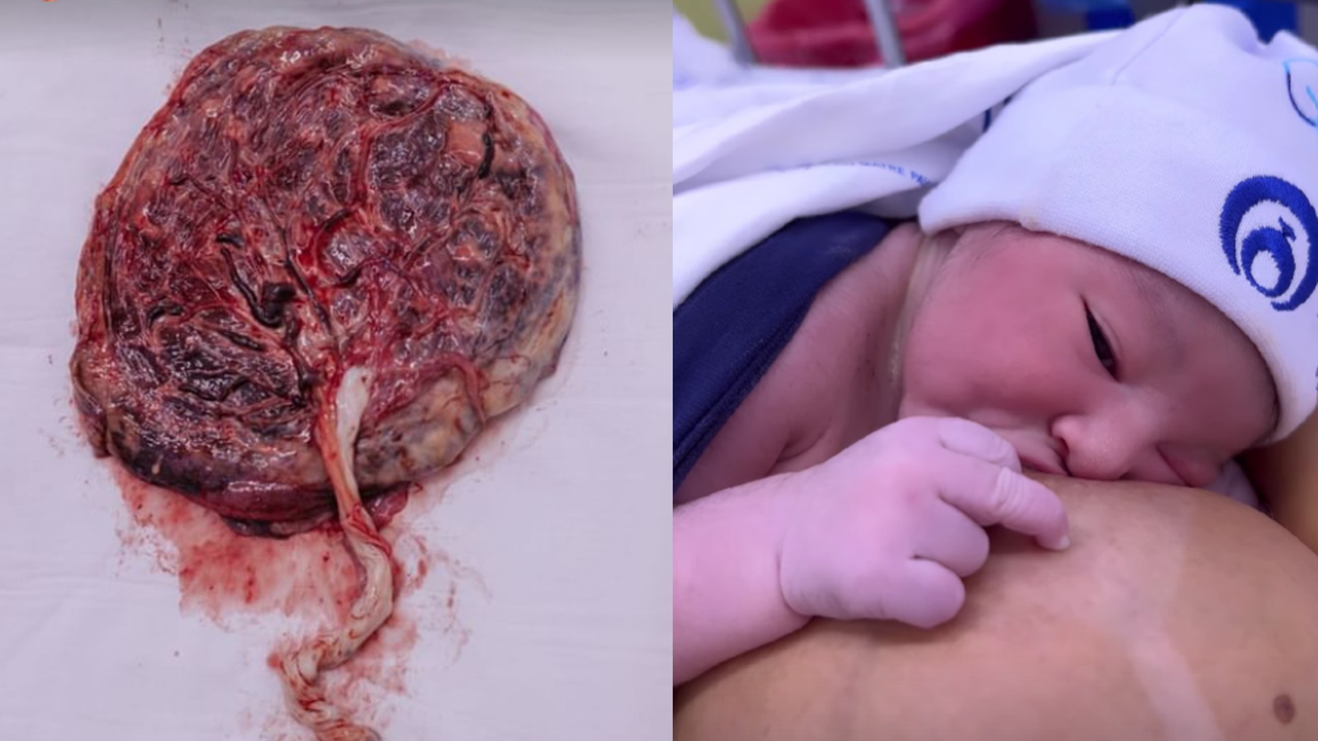 Placenta e Gabriel, primeiro filho de Fernanda Lacerda, Mendigata do P&acirc;nico