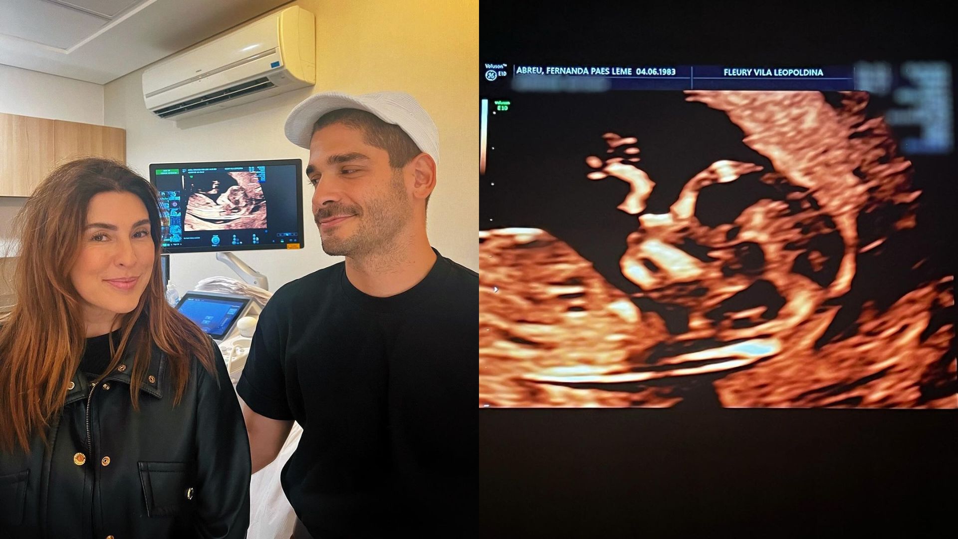 Fernanda Paes Leme e Victor Sampaio com ultrassom da filha