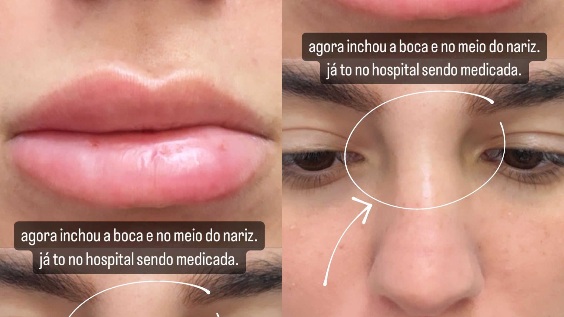 Stories de Petra Mattar sobre alergia e virose