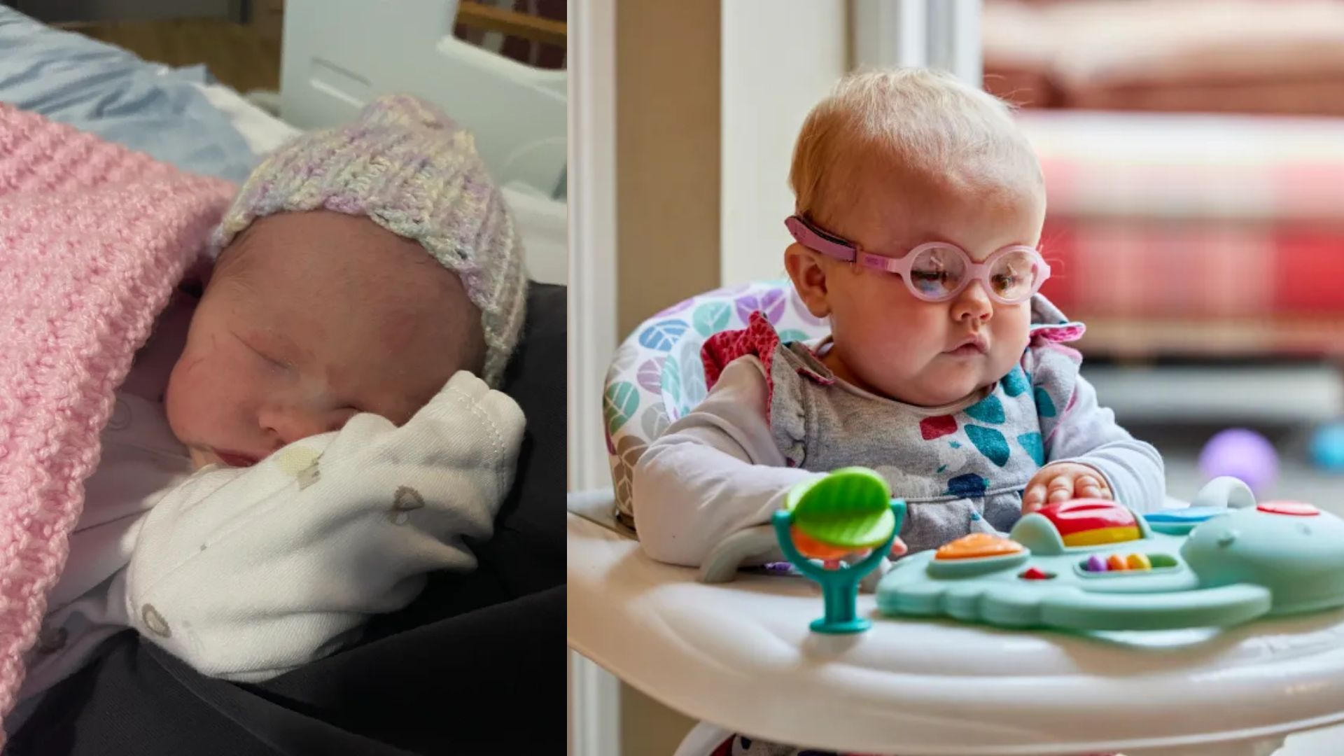 Beb&ecirc; nasce sem olhos 