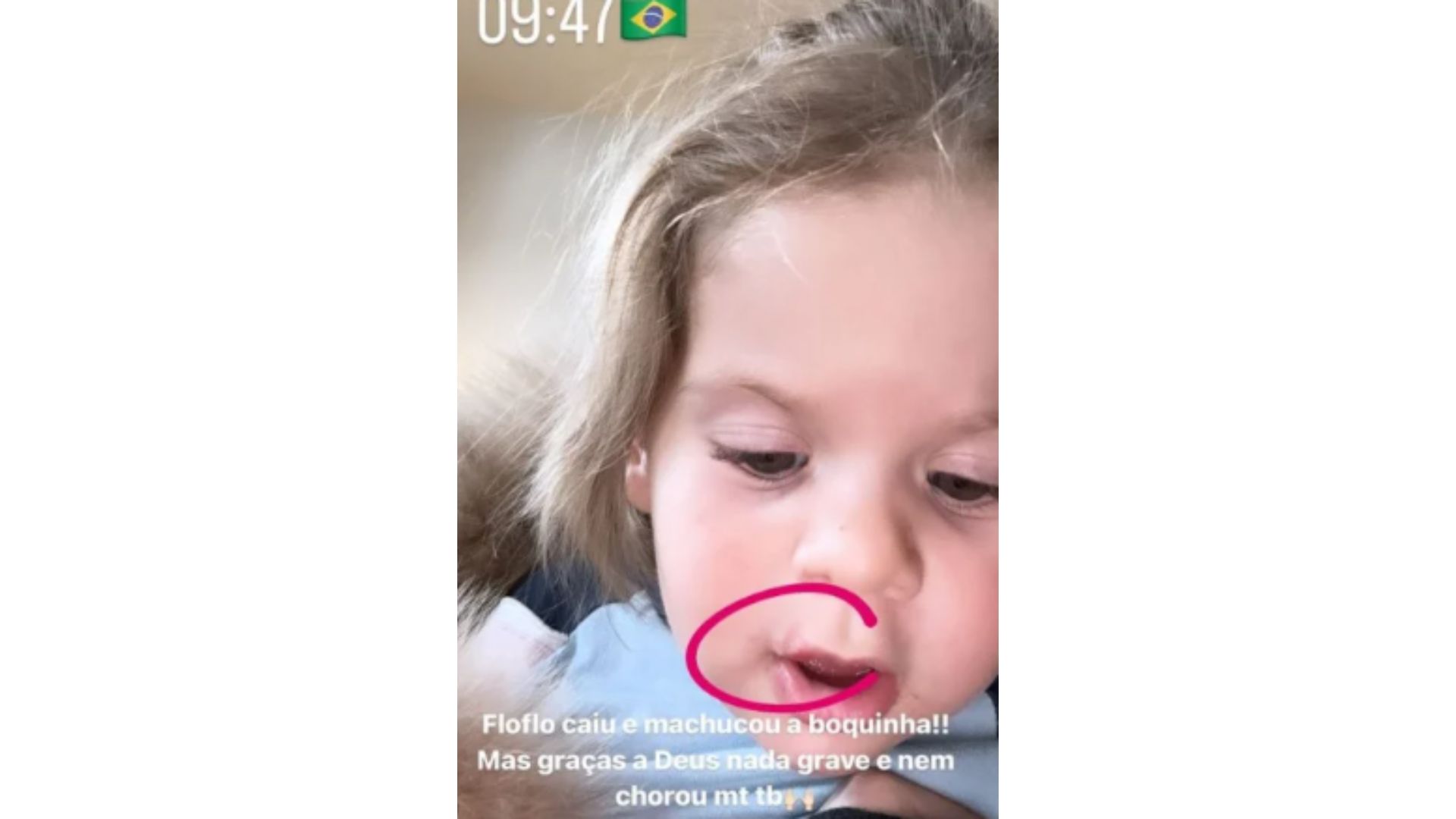 Maria Flor com a boca machucada 