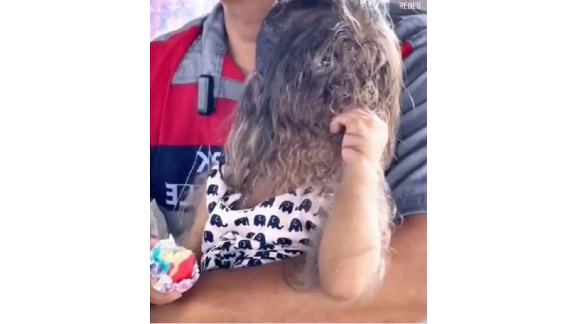 A menina nasceu com uma doen&ccedil;a rara