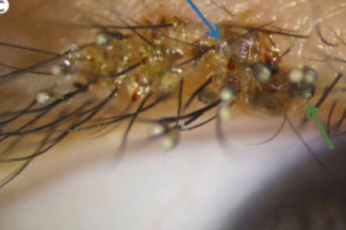 O caso é considerado extremamente raro