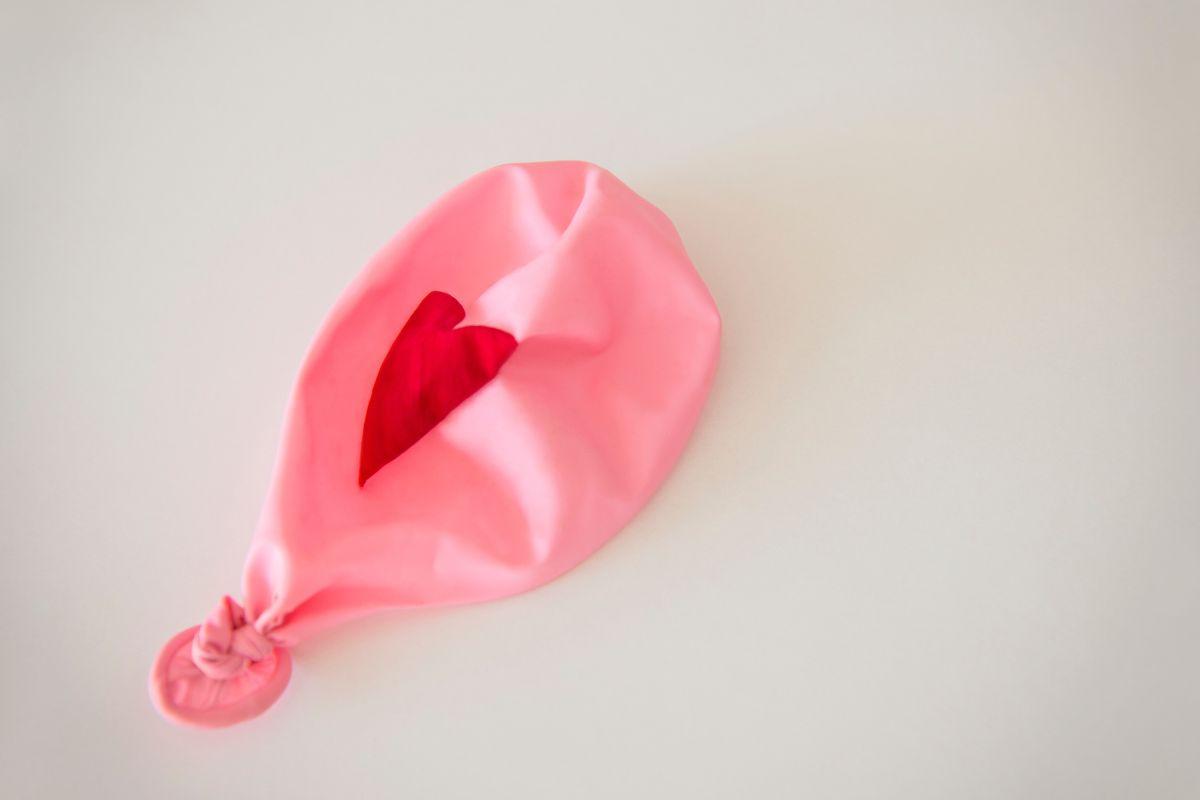 A cerclagem uterina é um procedimento feito por meio de uma cirurgia, em que se costura o colo uterino para evitar o nascimento antes da hora prevista