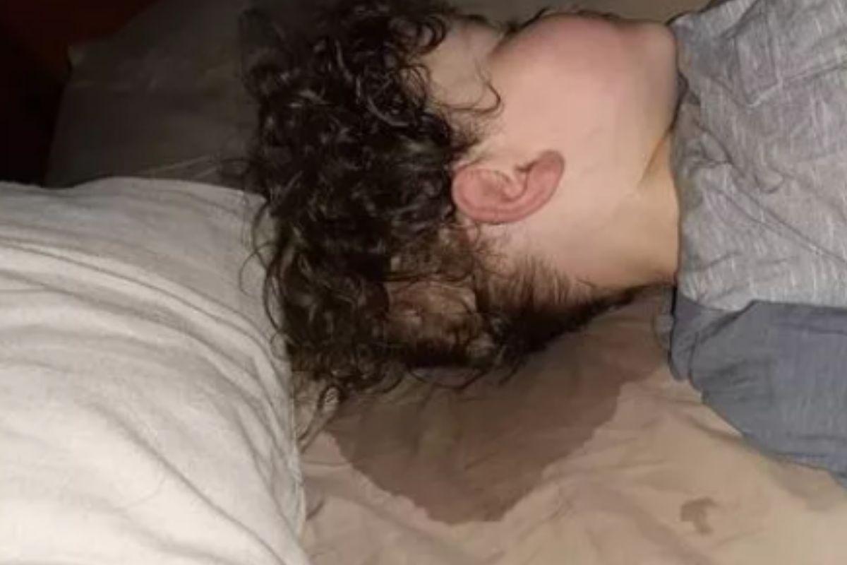 Reação alérgica do menino ao comer inumeros alimentos 