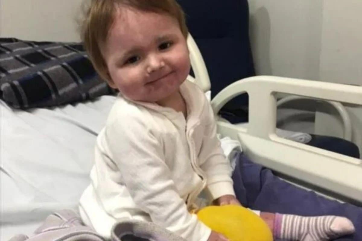 Helena, de apenas 1 ano de idade, sofreu graves queimaduras