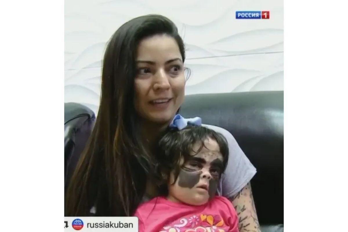 Menina com mancha no rosto