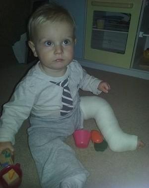 Maxwell ficou 4 semanas com a perna imobilizada