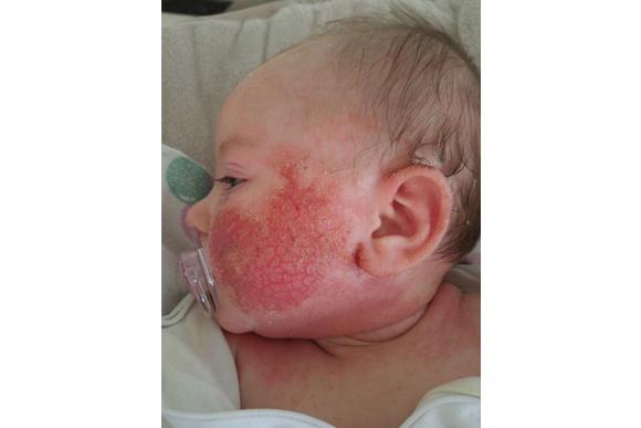 (Foto: Caters News Agency)