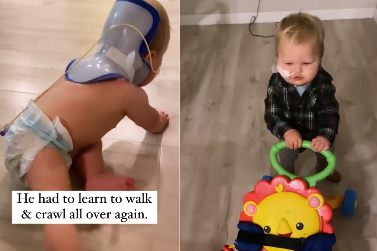 Watson teve que reaprender a engatinhar e andar